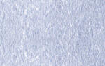 Ursus ALUKARTON 300G.35x50CM,10BG.SILBER